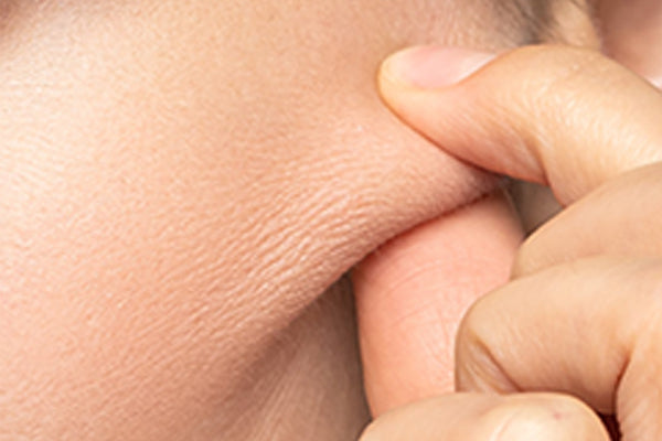 Loss of skin elasticity is one of the signs of skin aging.