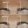 Before and after skin results using Global Repair Advanced Elixir