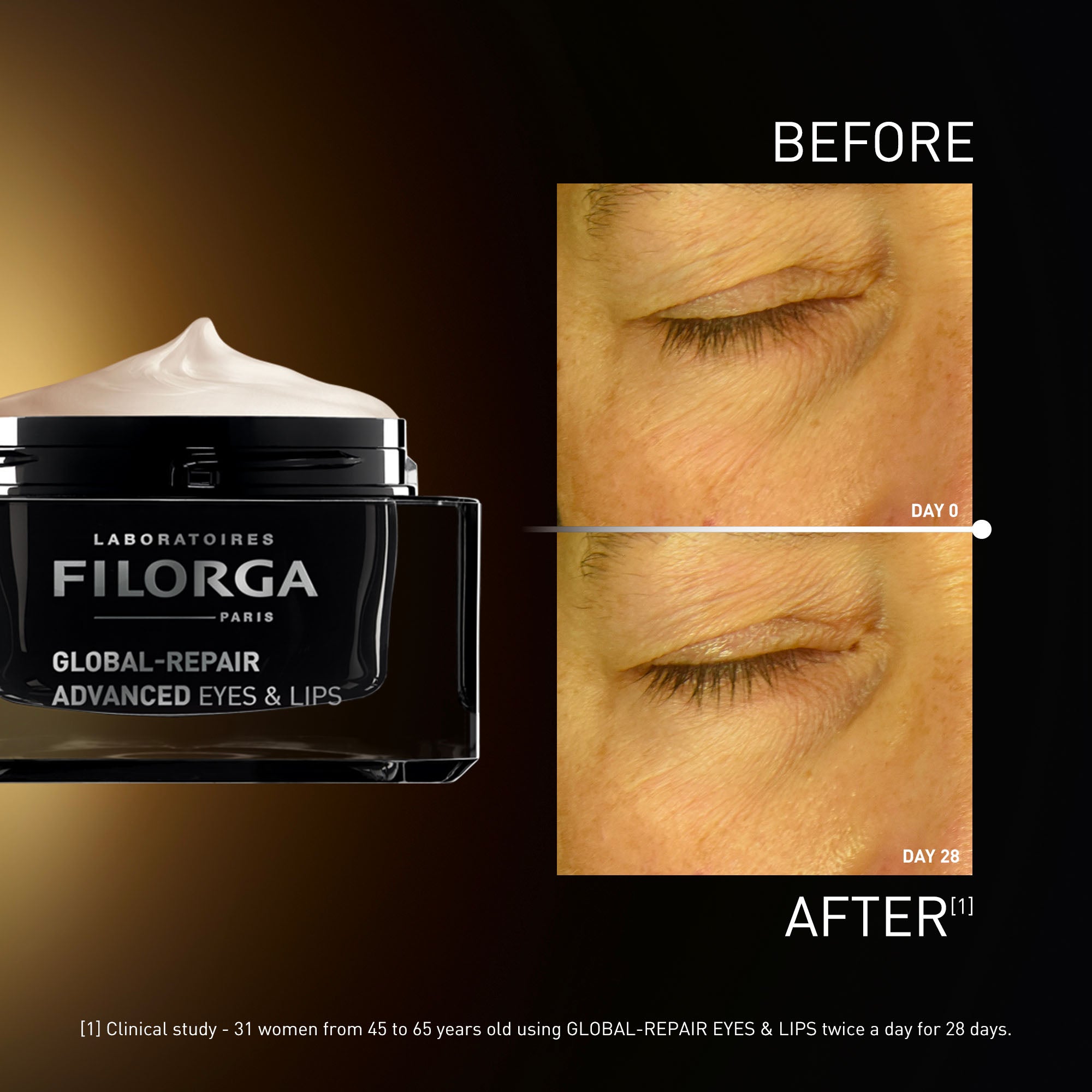 GLOBAL-REPAIR ADVANCED EYES & LIPS – Filorga International