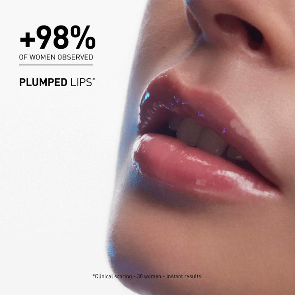 Clinical study and efficacy results for Hyalu Filler Lips