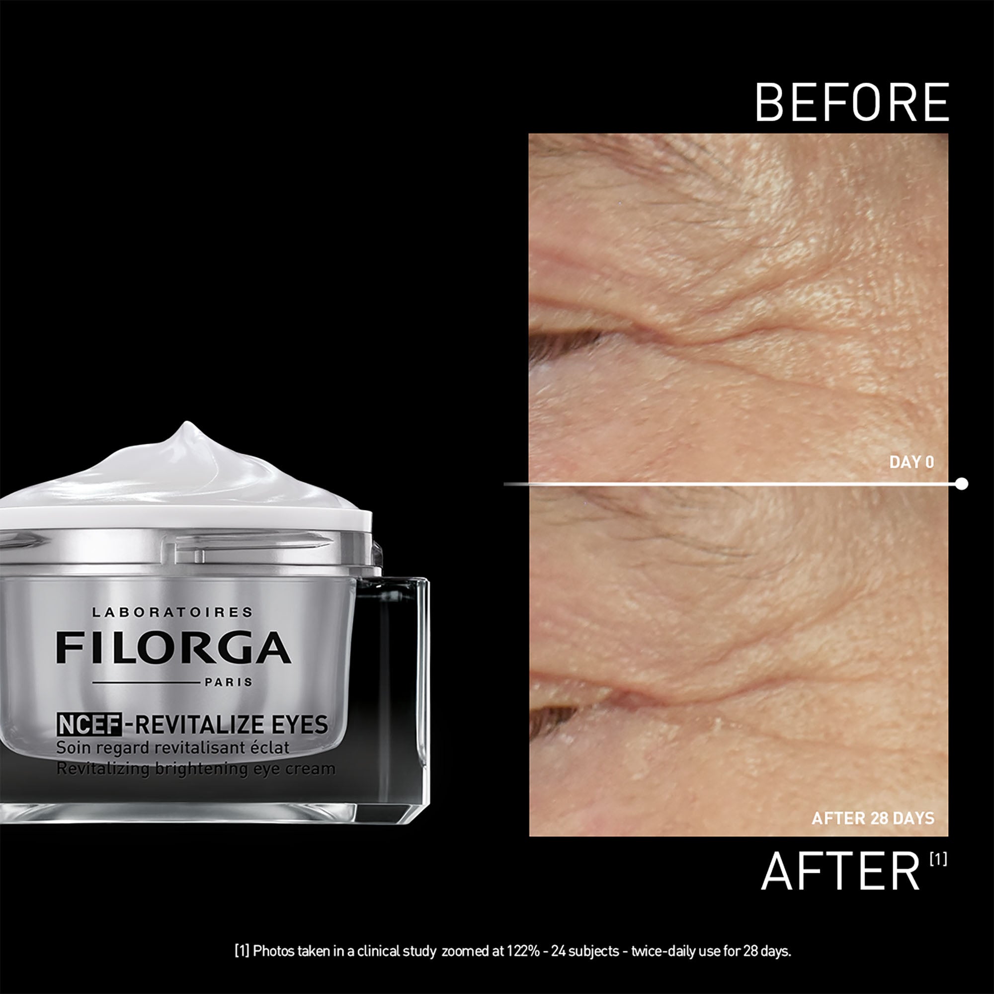 NCEF-REVITALIZE EYES – Filorga International