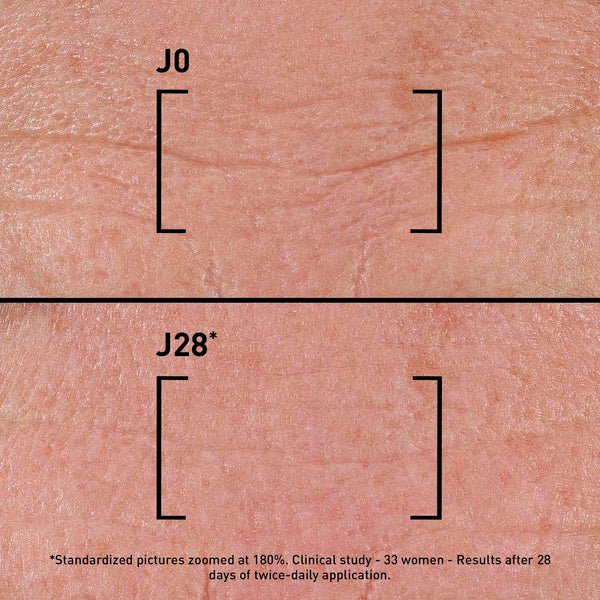 Before and after skin results using Time Filler Intensive 5Xp