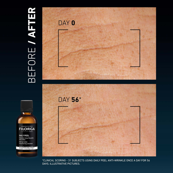 DAILY PEEL – WRINKLES