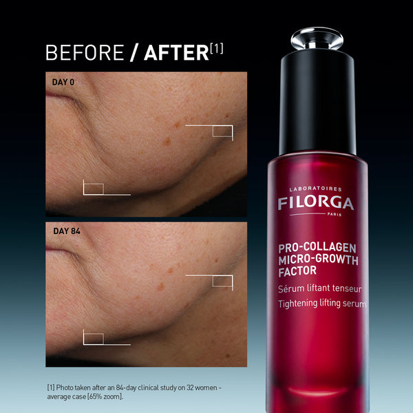 PRO-COLLAGEN MICRO-GROWTH FACTOR SERUM