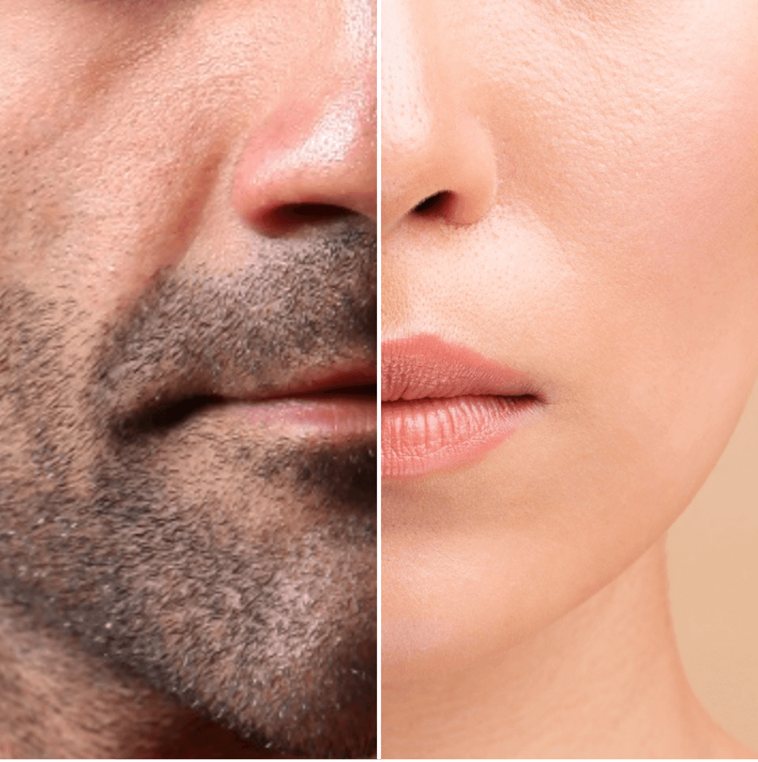 A man's skin and a woman's skin have a lot in common, but they also differ.