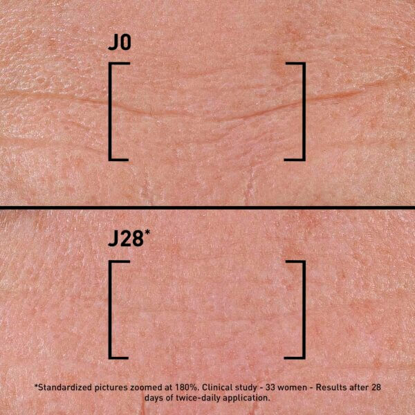 SERUM TF INTENSIVE 5XP_3540550017198_3_BEFORE AFTER_EN