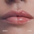 HYALU FILLER LIPS_3540550017396_4_BEFORE_AFTER_EN