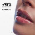 HYALU FILLER LIPS_3540550017396_6_RESULTS_EN