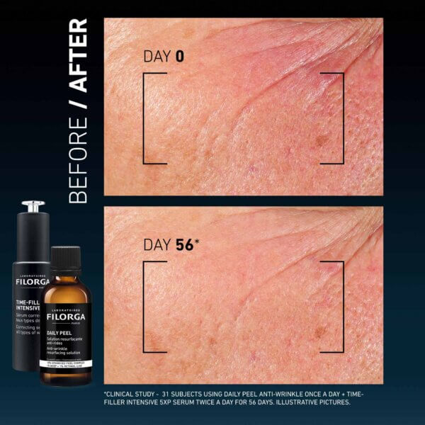 Before-After-protocol_2000x2000_WRINKLES_BLEU